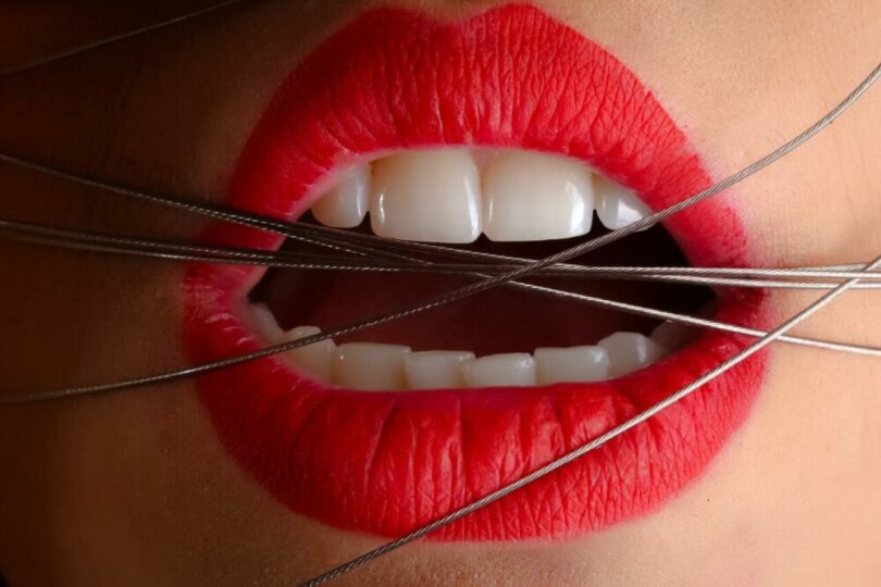 鐵絲在嘴唇周圍