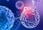 Exosome