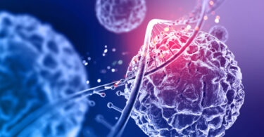 Exosome